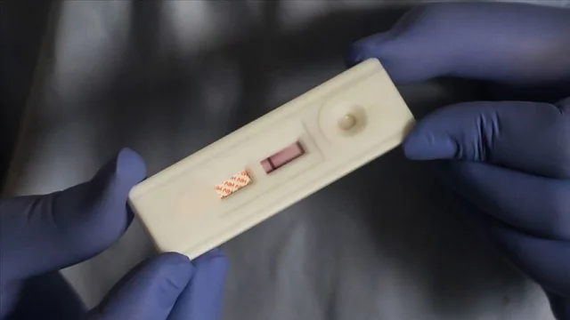 Almanya'da HIV Tedavisinde Umut Veren Antikor Keşfi