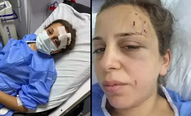 Saatlerce şiddet uygulayan eşini bıçaklamıştı! Mahkeme kararını verdi