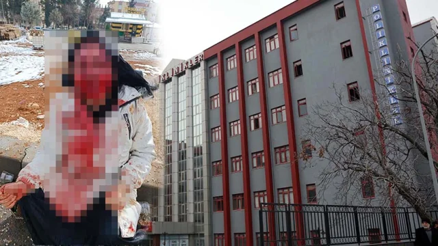 Boşanmak isteyen eşine kaldırım taşıyla saldırdı! 