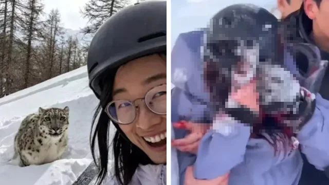 Çin'de akılalmaz olay! Selfie merakı hayatına mal oluyordu: Yüzü parçalandı 