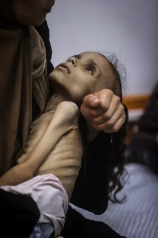 Gazze'de Meryem'in Yaşam Mücadelesi: İsrail Ablukası Altında Açlıkla Savaş