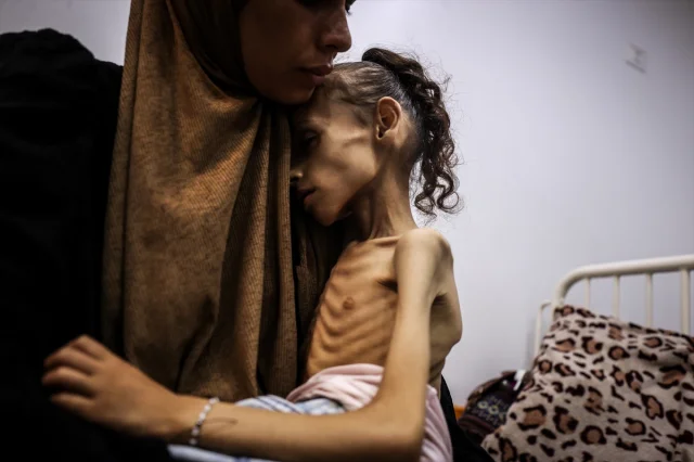 Gazze'de Meryem'in Yaşam Mücadelesi: İsrail Ablukası Altında Açlıkla Savaş