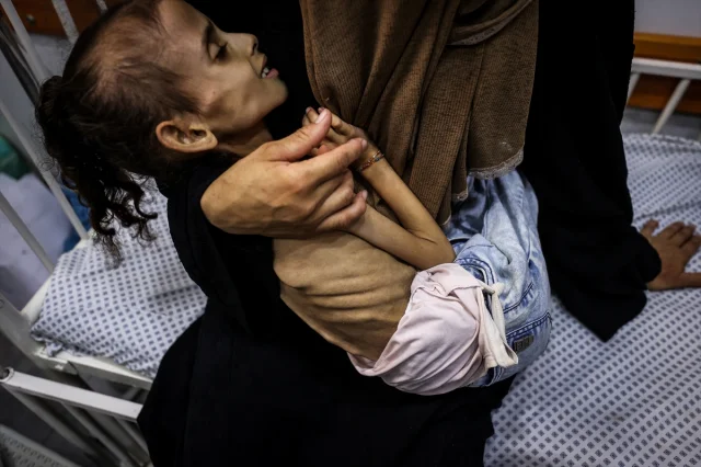 Gazze'de Meryem'in Yaşam Mücadelesi: İsrail Ablukası Altında Açlıkla Savaş