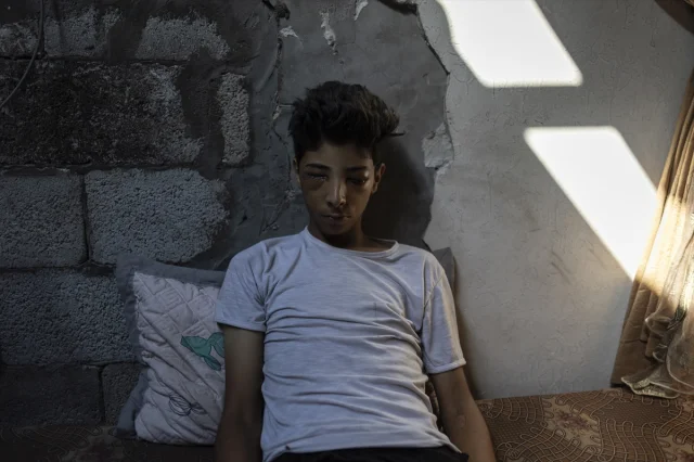 Gazze'de Yaşanan İnsanlık Dramı: 15 Yaşındaki Taha'nın Kaybedilen Gözleri ve Hayalleri
