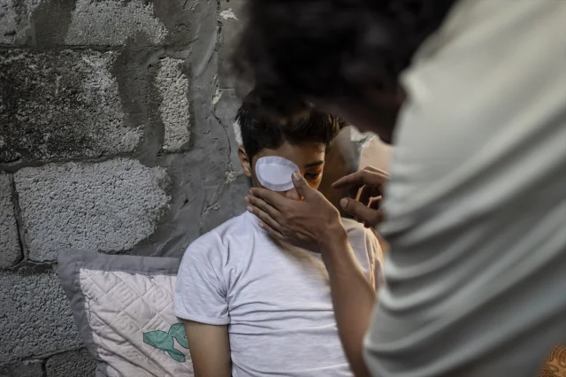 Gazze'de Yaşanan İnsanlık Dramı: 15 Yaşındaki Taha'nın Kaybedilen Gözleri ve Hayalleri