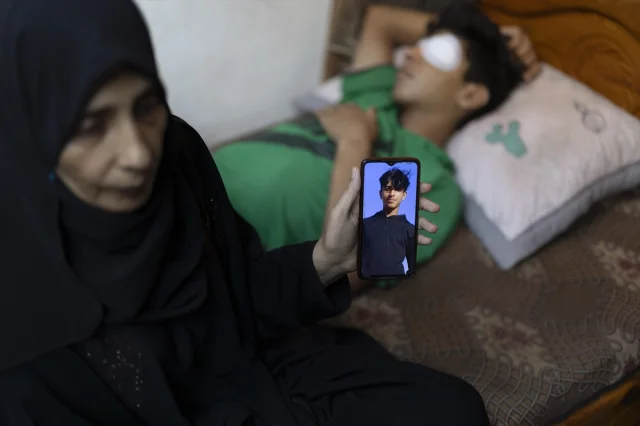 Gazze'de Yaşanan İnsanlık Dramı: 15 Yaşındaki Taha'nın Kaybedilen Gözleri ve Hayalleri