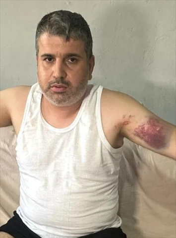 Adana'da Miras Kavgası Beyzbol Sopalı Saldırıya Dönüştü