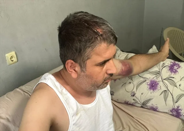 Adana'da Miras Kavgası Beyzbol Sopalı Saldırıya Dönüştü