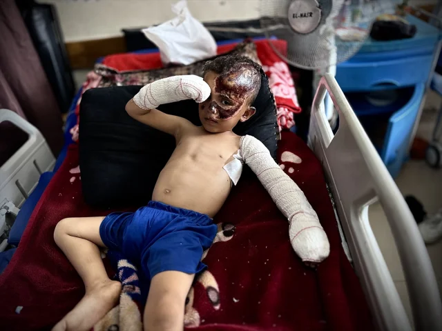 Gazze'de Küçük Ahmed'in Yürek Burkan Hikayesi