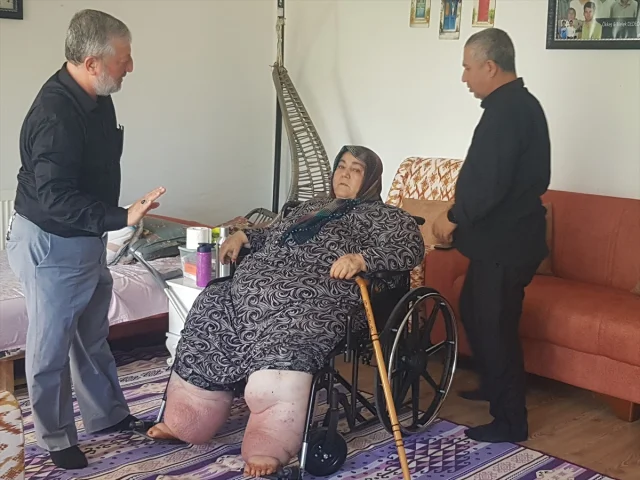 Fil Hastası Emine Teyze'nin Hayatına Tekerlekli Sandalye Umudu