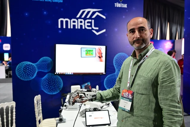 Yerli Yapım Robotik El Rehabilitasyon Sistemi Sağlık Hizmetlerini Dönüştürecek