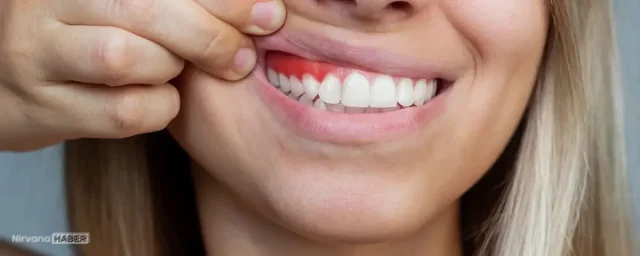 Diş eti kanaması hafife alınmamalı: Ciddi hastalıkların ilk sinyali olabilir