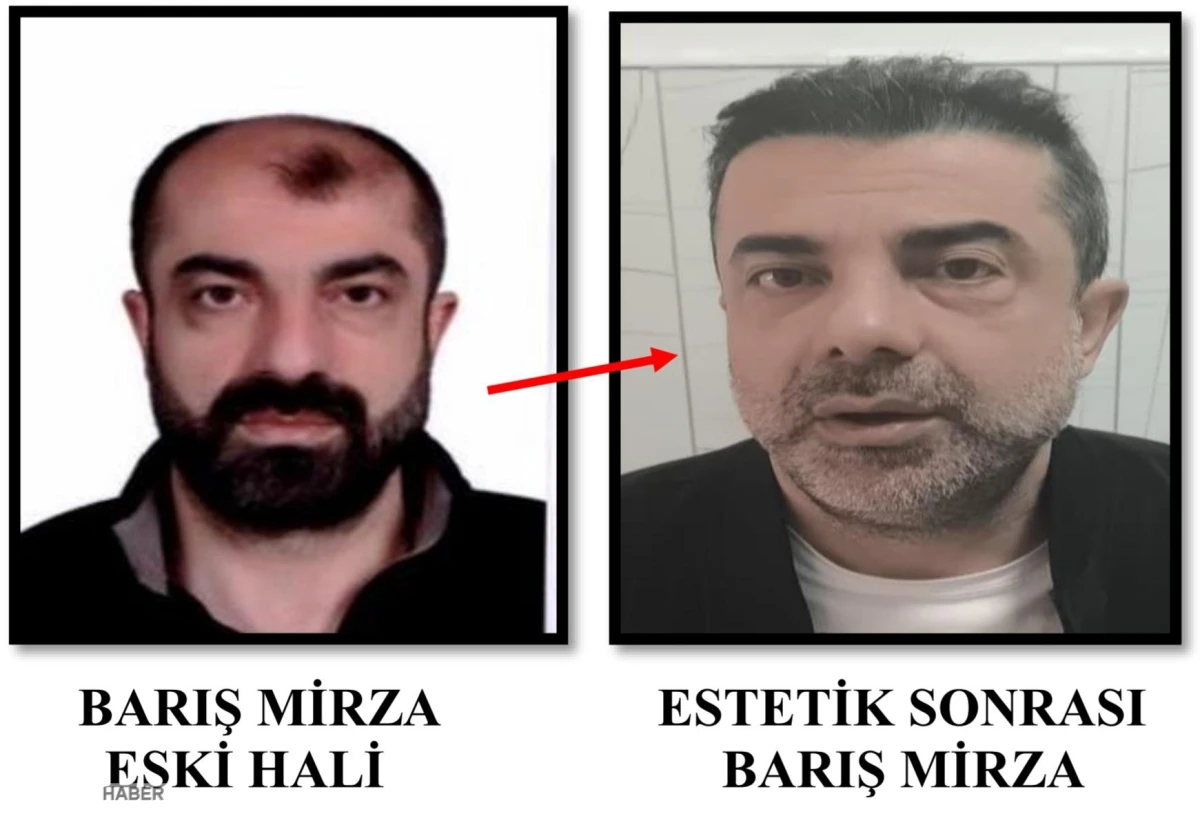 Ameliyatla yüzünü değiştirip kaçtı: 7 yıl sonra yakalandı