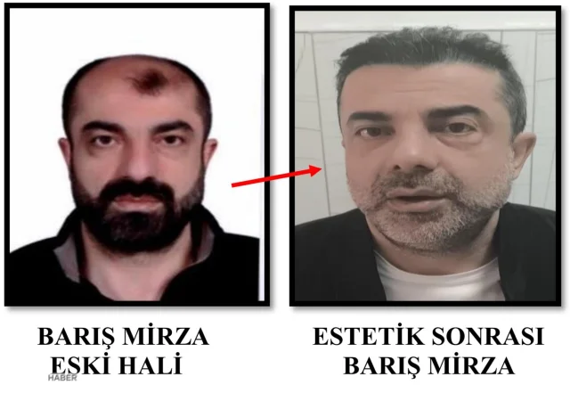 Ameliyatla yüzünü değiştirip kaçtı: 7 yıl sonra yakalandı