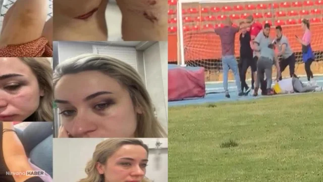 Yaşadıklarını sosyal medyadan duyurmuştu: Eski eşi darbedildi