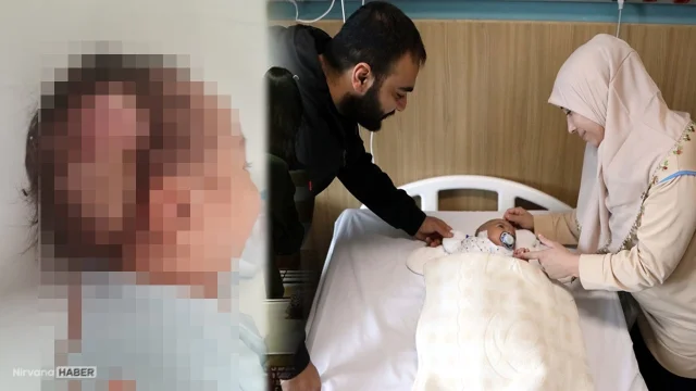 Hızla büyüyüp beynine baskı yapıyordu! Dünyada böylesi nadir görülüyor