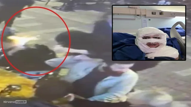 Genç kadının yüzüne kolonya döküp yakan sanık "Pişmanım" dedi