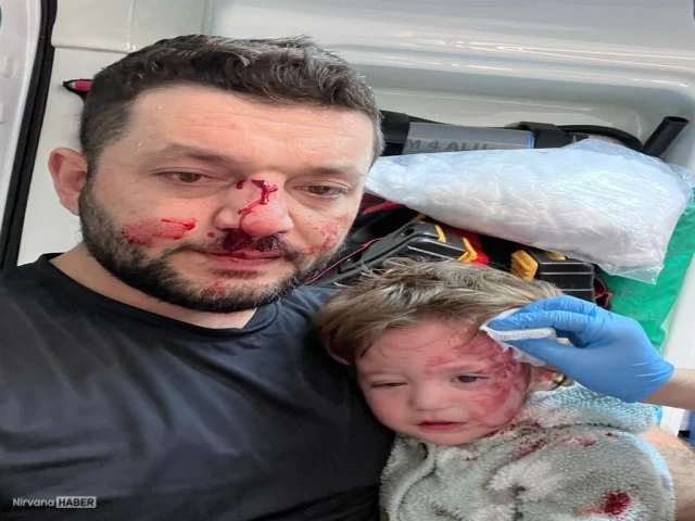 Yalova'da 14 aylık bebeği yaraladığı iddia edilen sanığa tahliye kararı