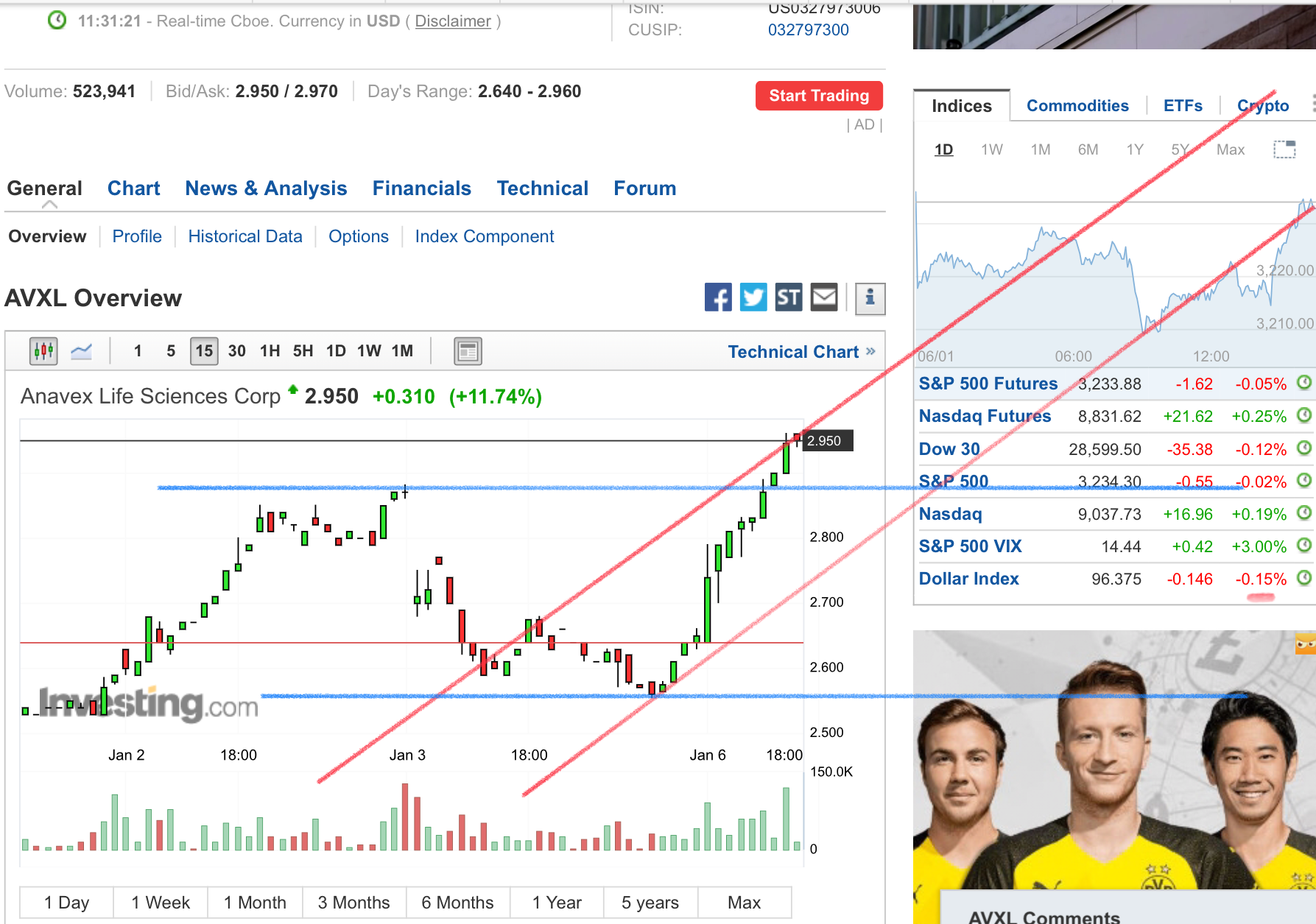 80654_AVXL_Anavex_Life_Sciences_Stock_Price___Investing.com.png