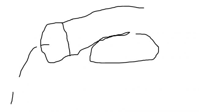 Møgsprederen