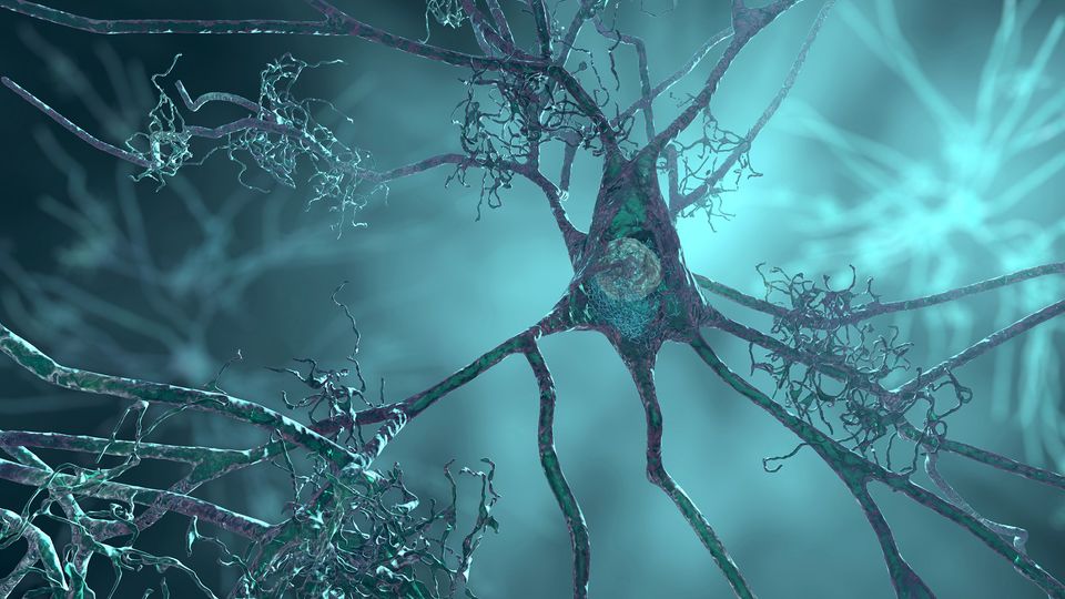 The Emerging Battle Against Brain Aging: From Proteins to Kitchen Habits