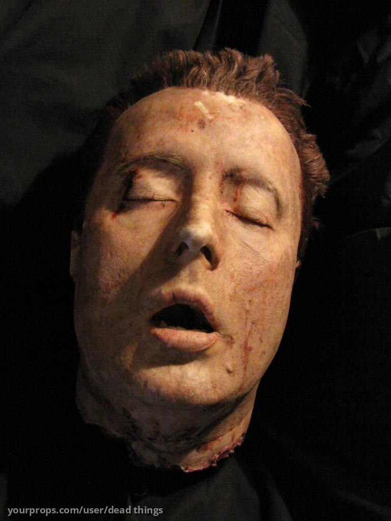 Gary Tunnicliffe Severed Head – Autopsy (2008) – image 1