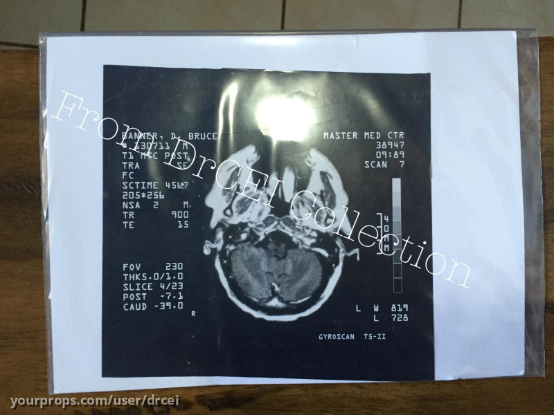 Bruce Banner's MRI scan – The Incredible Hulk (2008) – image 1