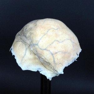 Quinlan's Bald Cap – The Strain (2014)