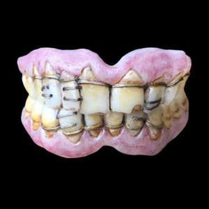 The King & Queen\\\'s Dental Veneers – The Green Knight (2021)