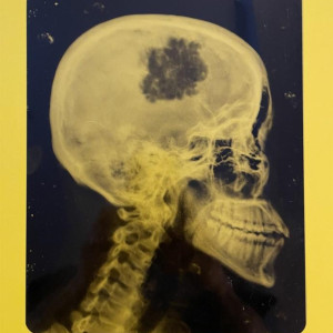 Quinn head x-ray – Into the Badlands (2015)